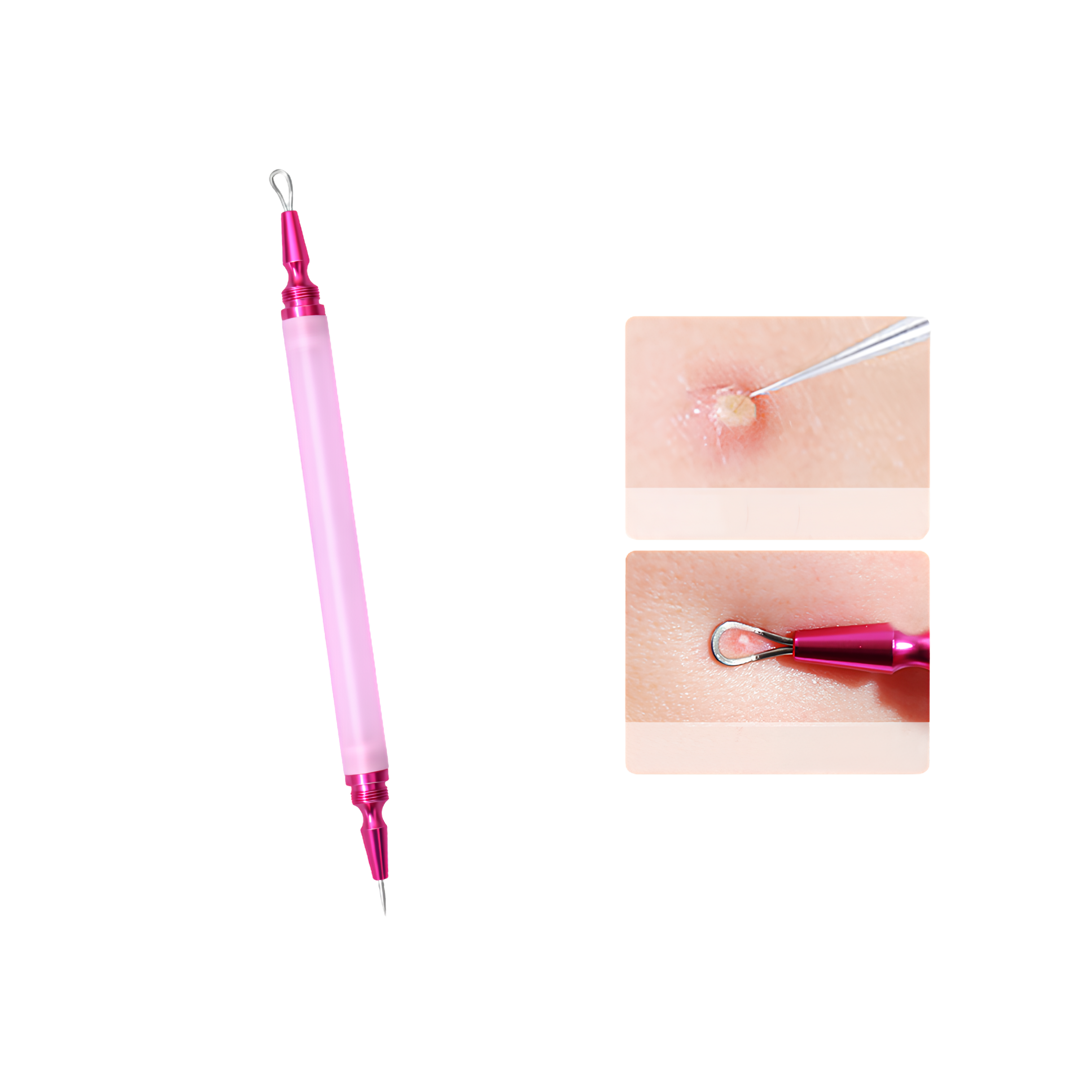 AcneMate Acne Lancet Tool