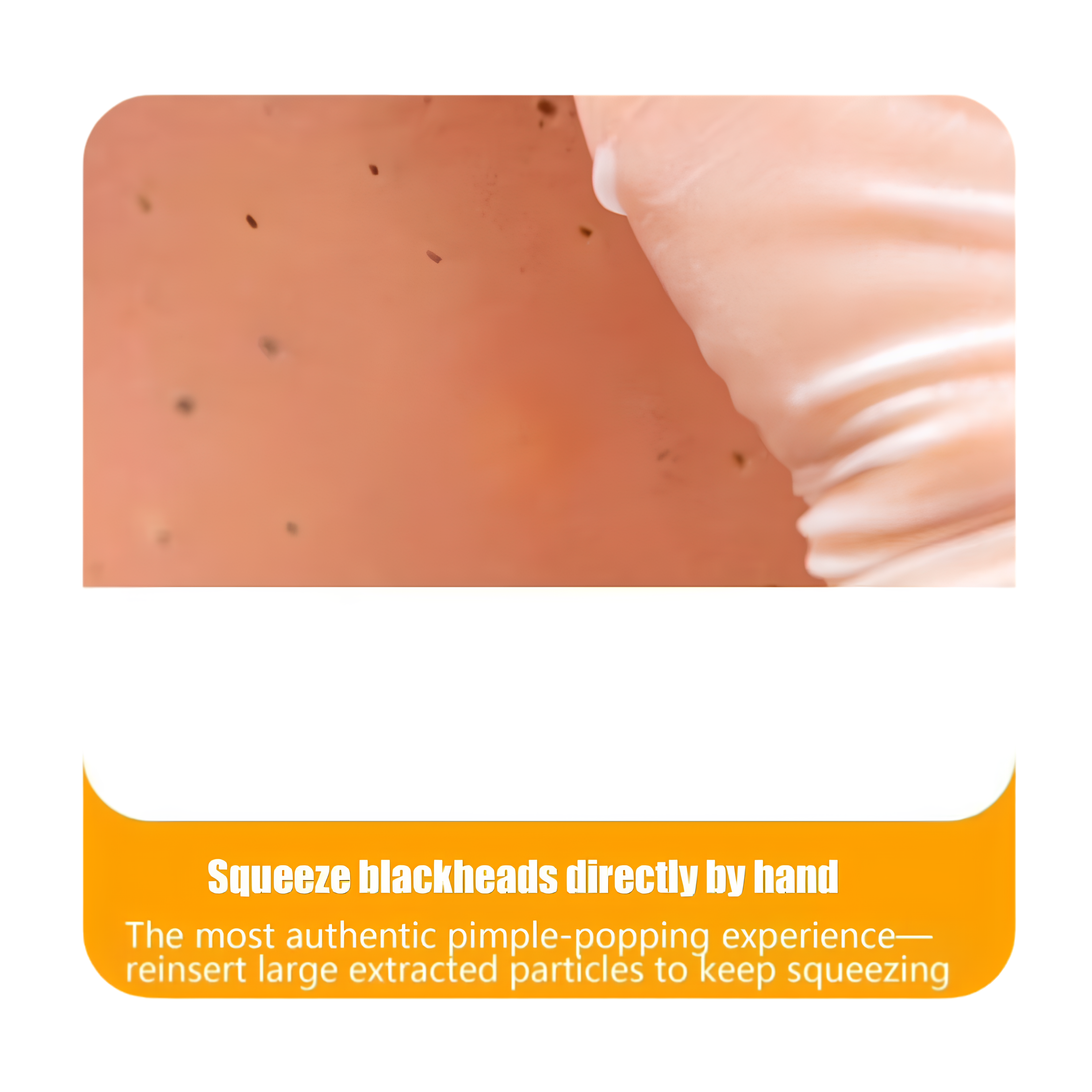 AcneMate Pop & Squeeze Head
